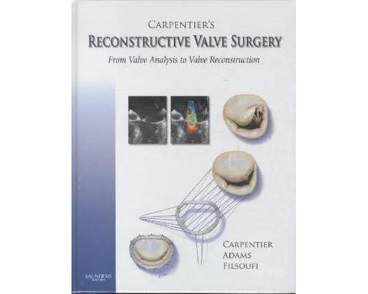 Carpentier's Reconstructive Valve Surgery