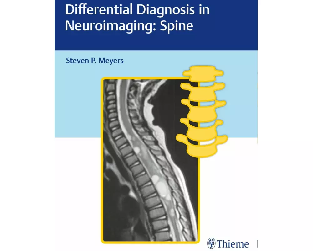 Differential Diagnosis in Neuroimaging: Spine