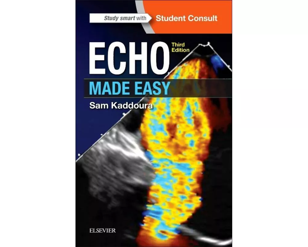 Echo Made Easy