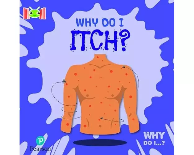 Bug Club Reading Corner: Age 5-7: Why Do I Itch?