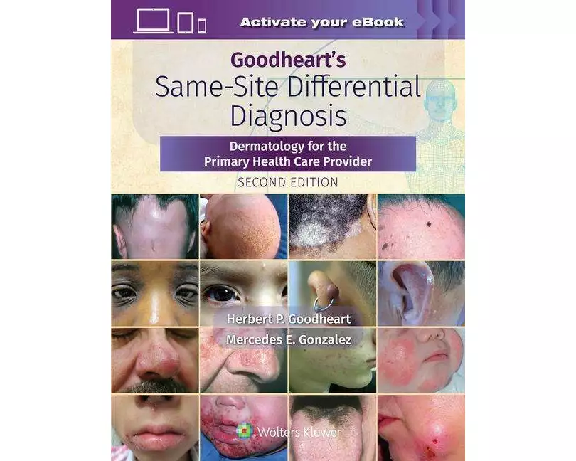 Goodheart's Same-Site Differential Diagnosis
