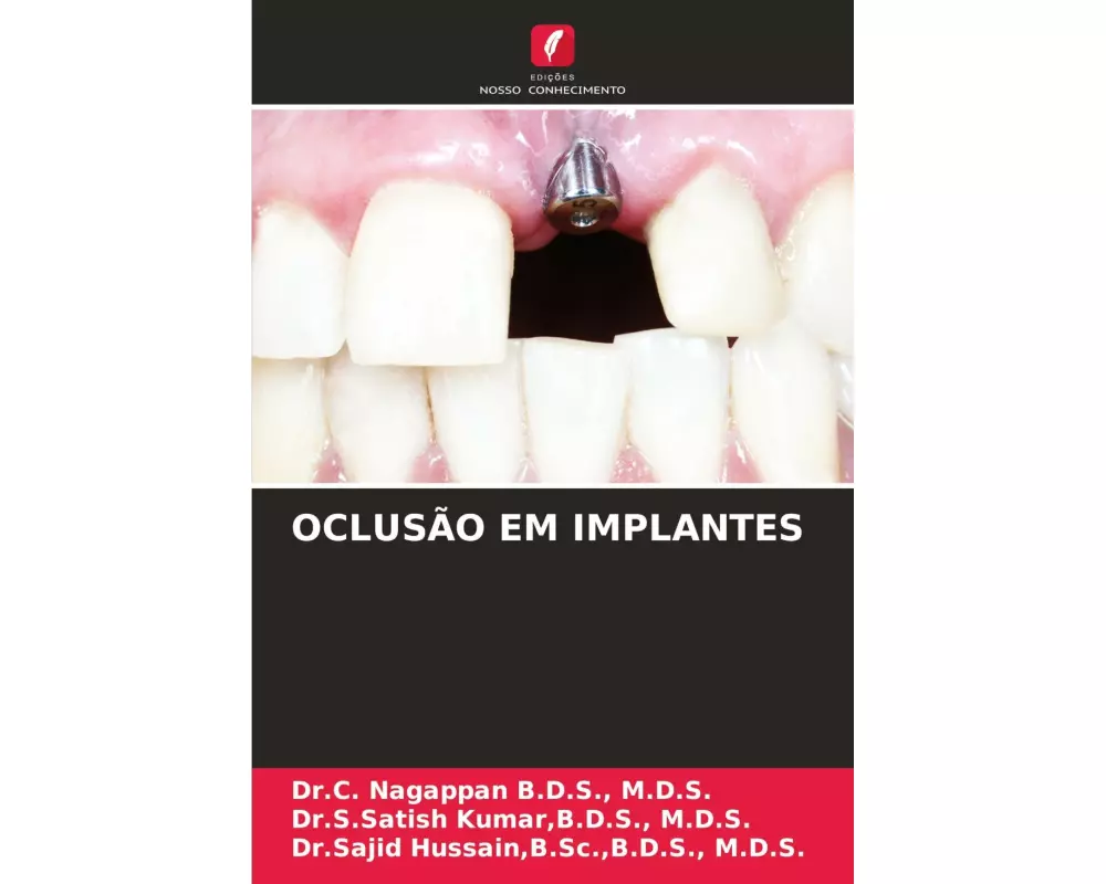 OclusÃo Em Implantes