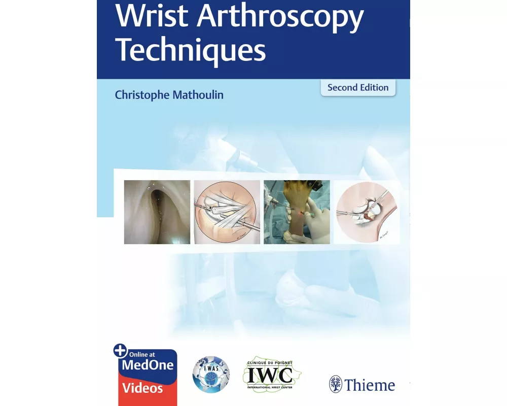 Wrist Arthroscopy Techniques
