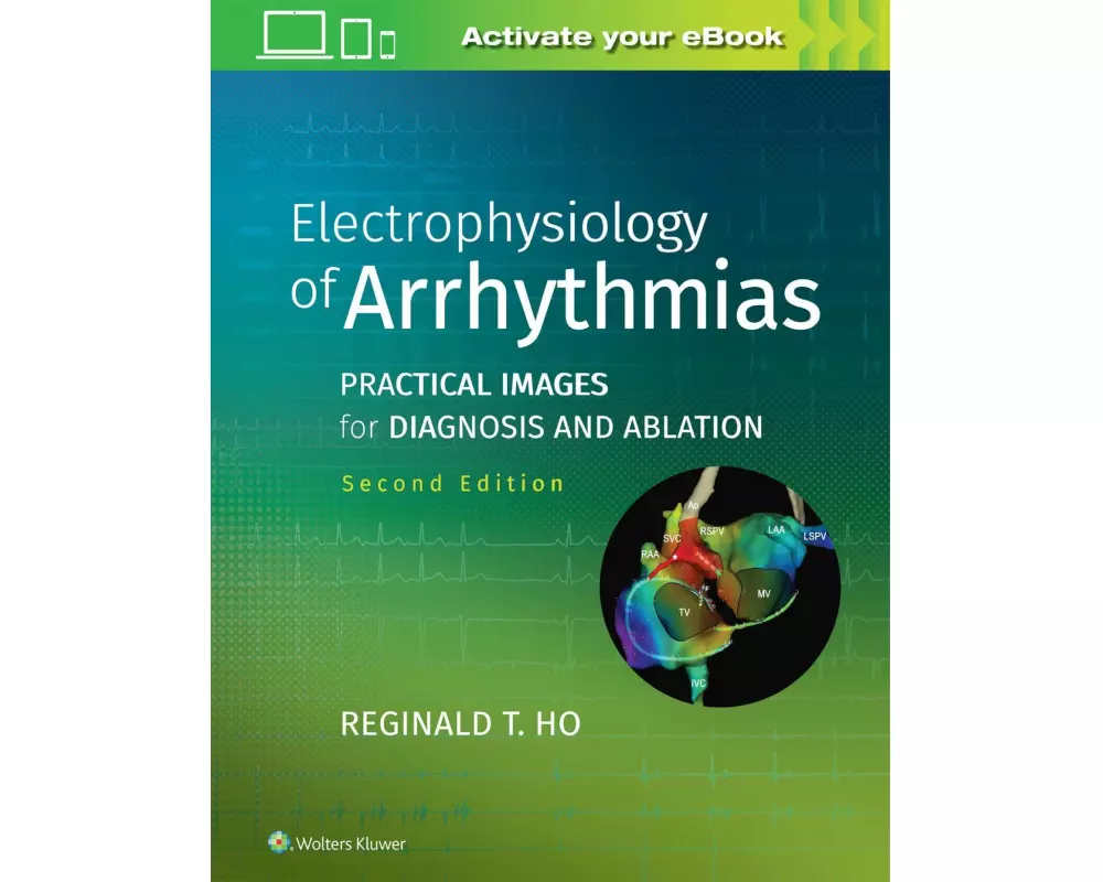 Electrophysiology of Arrhythmias