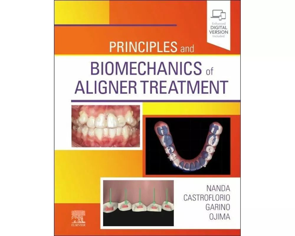 Principles and Biomechanics of Aligner Treatment