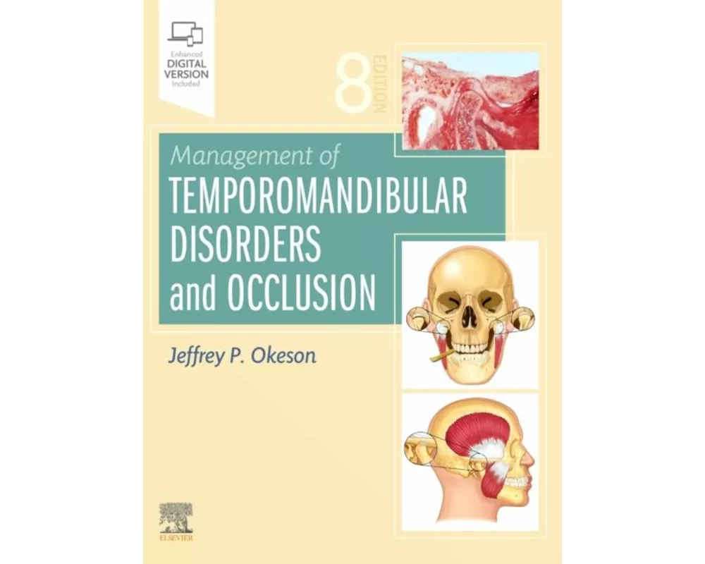 Management of Temporomandibular Disorders and Occlusion