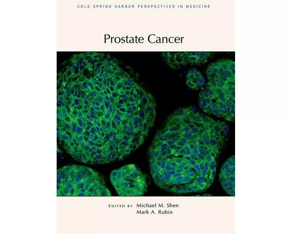 Prostate Cancer