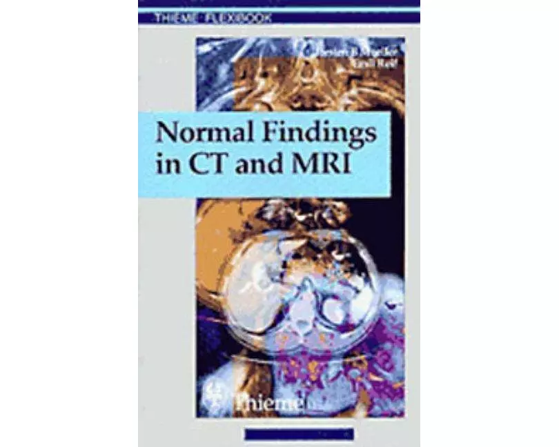 Normal Findings in CT and MRI, A1, print