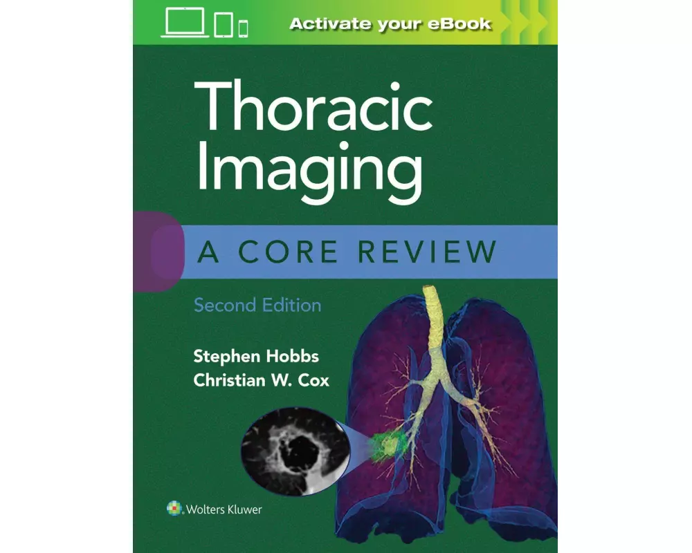Thoracic Imaging: A Core Review