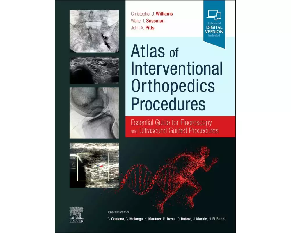 Atlas of Interventional Orthopedics Procedures