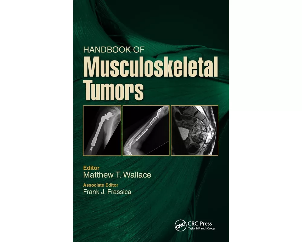 Handbook of Musculoskeletal Tumors