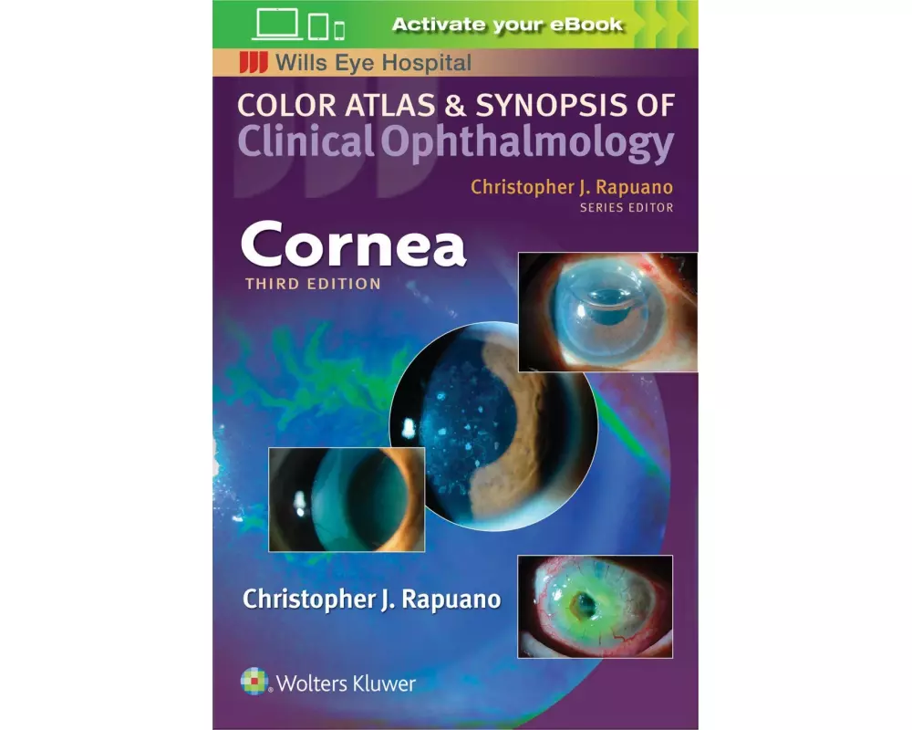 Cornea (Color Atlas and Synopsis of Clinical Ophthalmology)