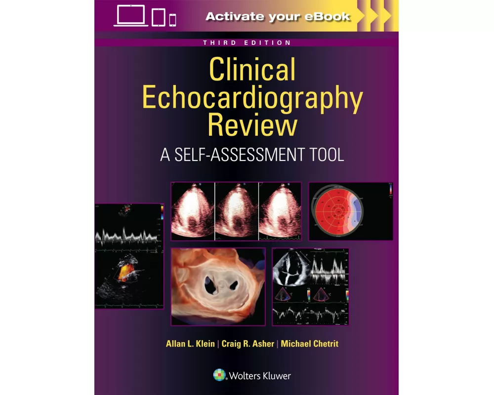 Clinical Echocardiography Review