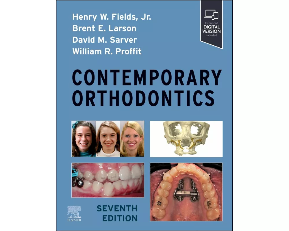 Contemporary Orthodontics