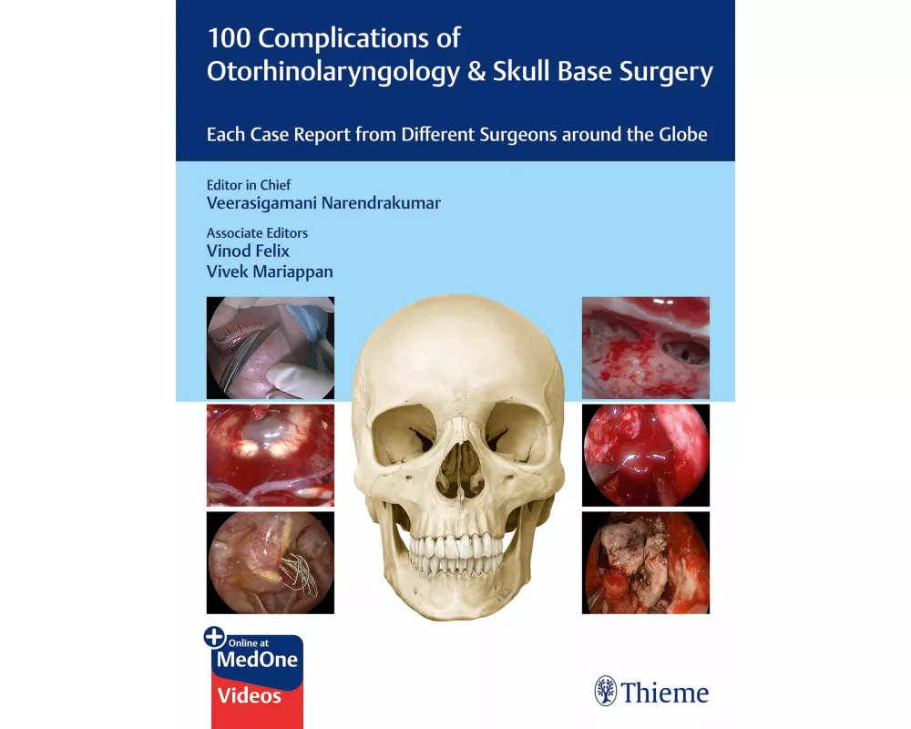100 Complications of Otorhinolaryngology & Skull Base Surgery