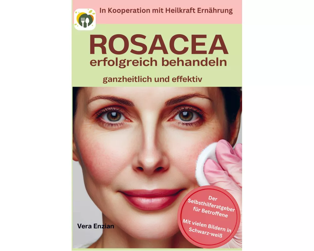 Rosacea erfolgreich behandeln - ganzheitlich und effektiv: Der Selbsthilferatgeber für Betroffene mit Tipps, die wirklich funktionieren