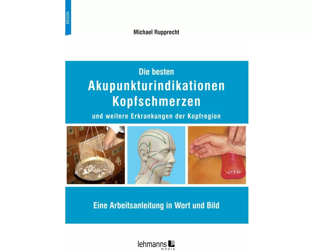 Die besten Akupunkturindikationen Kopfschmerzen und weitere Erkrankungen der Kopfregion