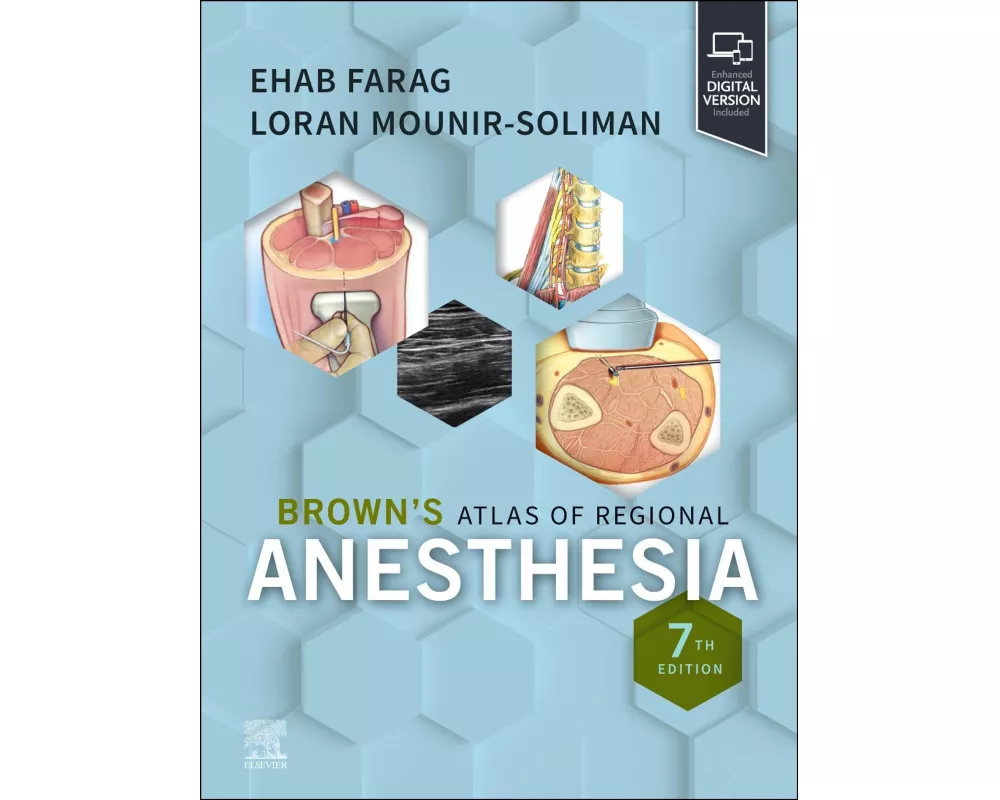 Brown's Atlas of Regional Anesthesia