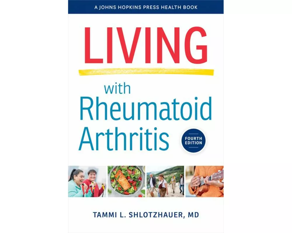 Living with Rheumatoid Arthritis