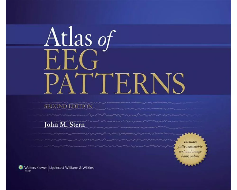 Atlas of EEG Patterns