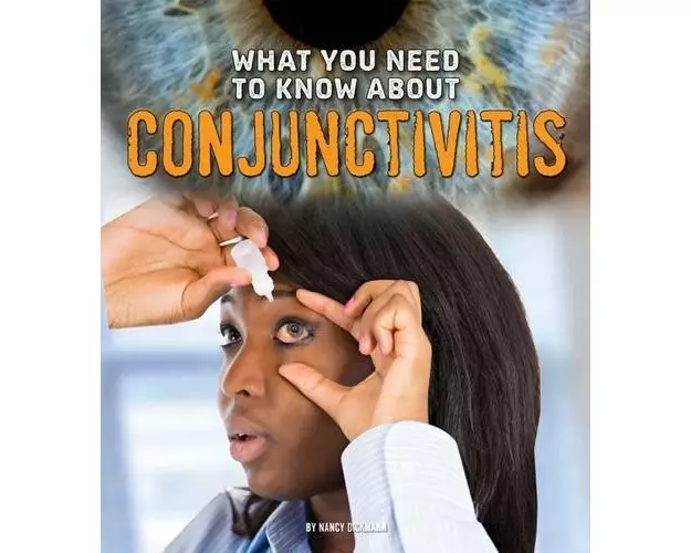 What You Need to Know About Conjunctivitis