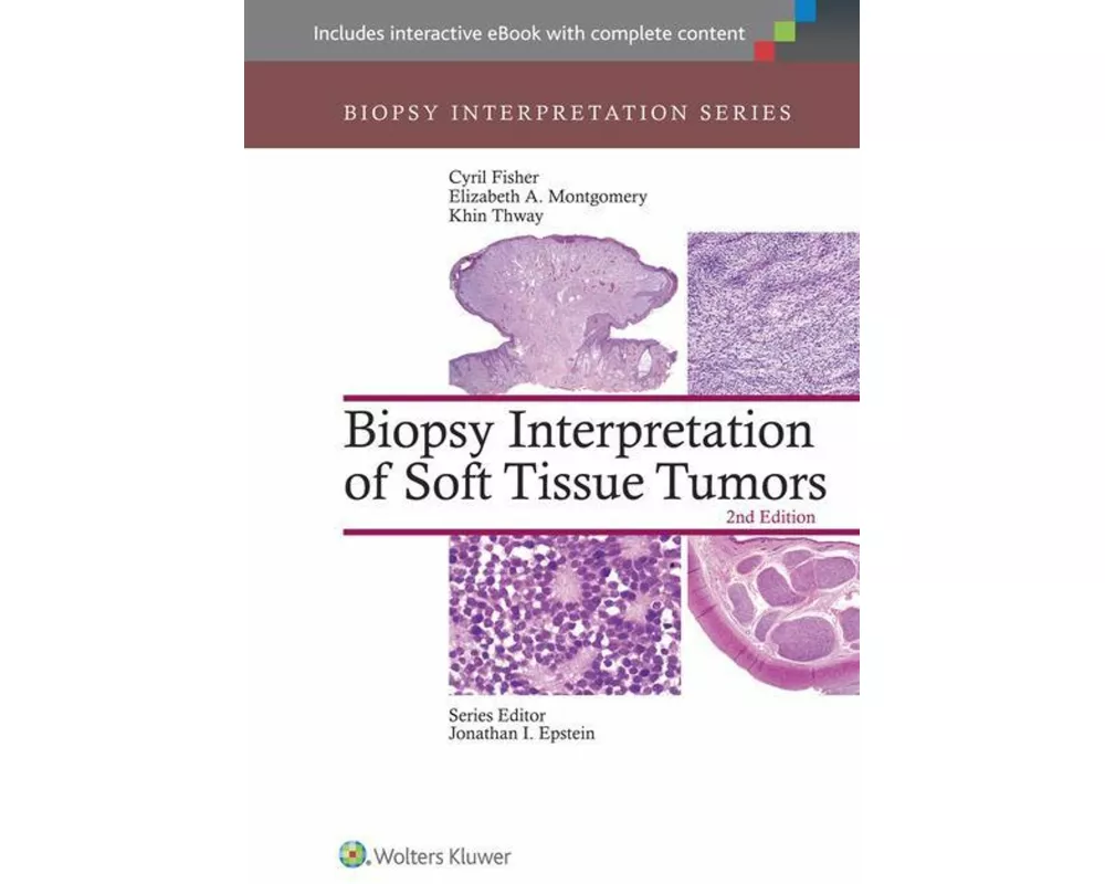 Biopsy Interpretation of Soft Tissue Tumors