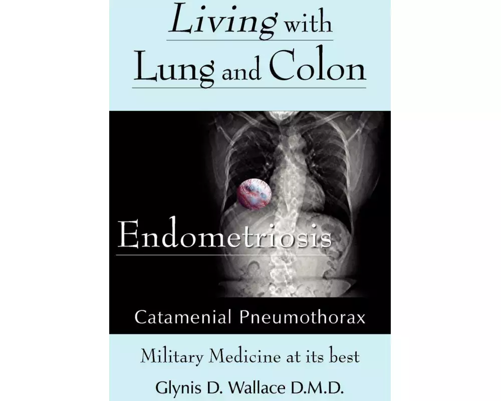 Living With Lung and Colon Endometriosis