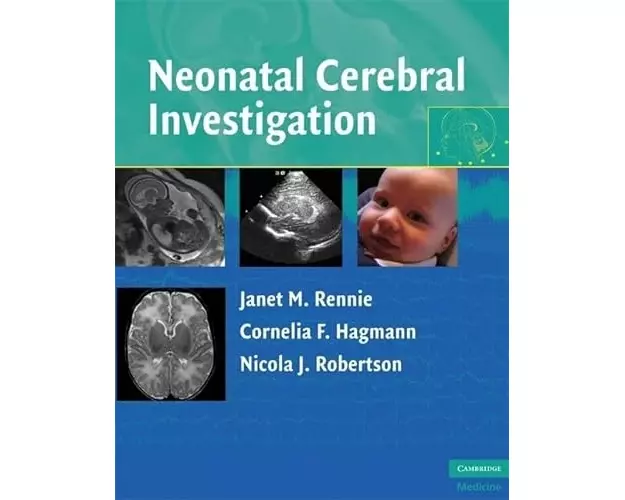Neonatal Cerebral Investigation