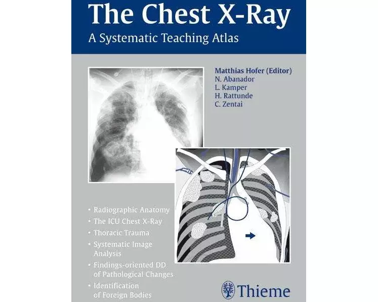 The Chest X-Ray
