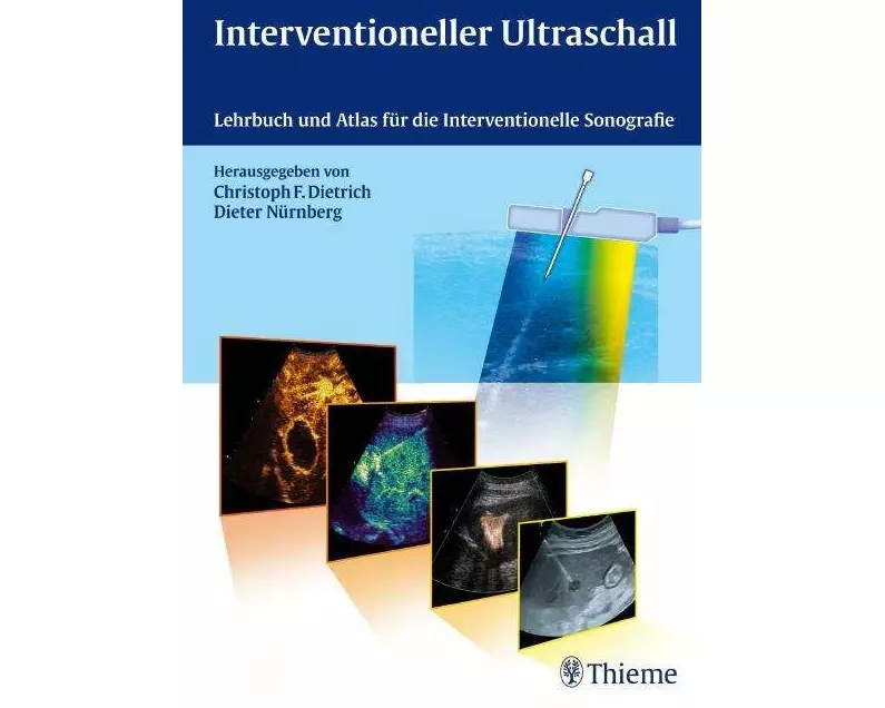 Interventioneller Ultraschall
