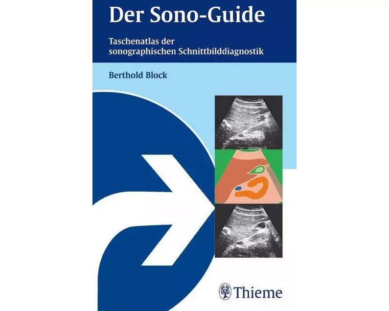Der Sono-Guide