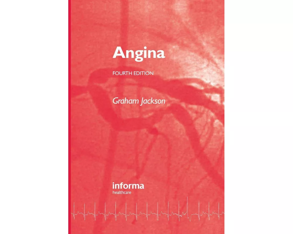 Angina