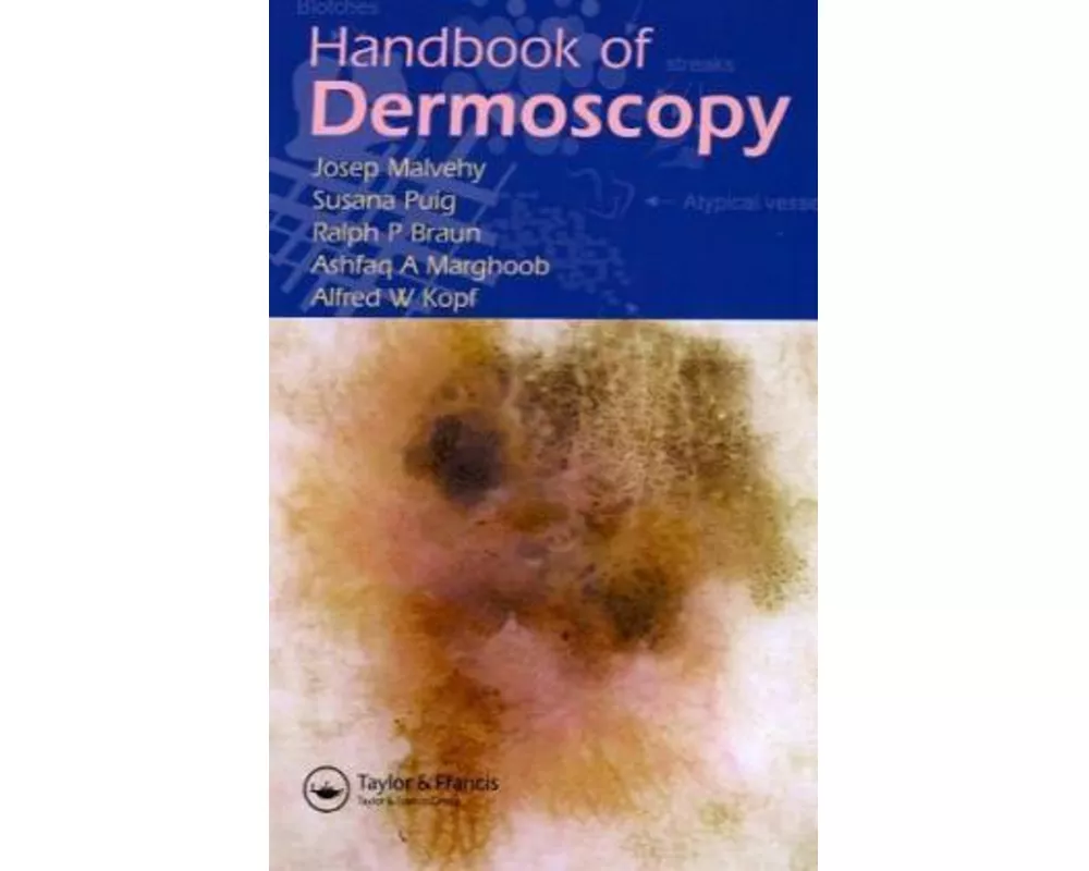 Handbook of Dermoscopy