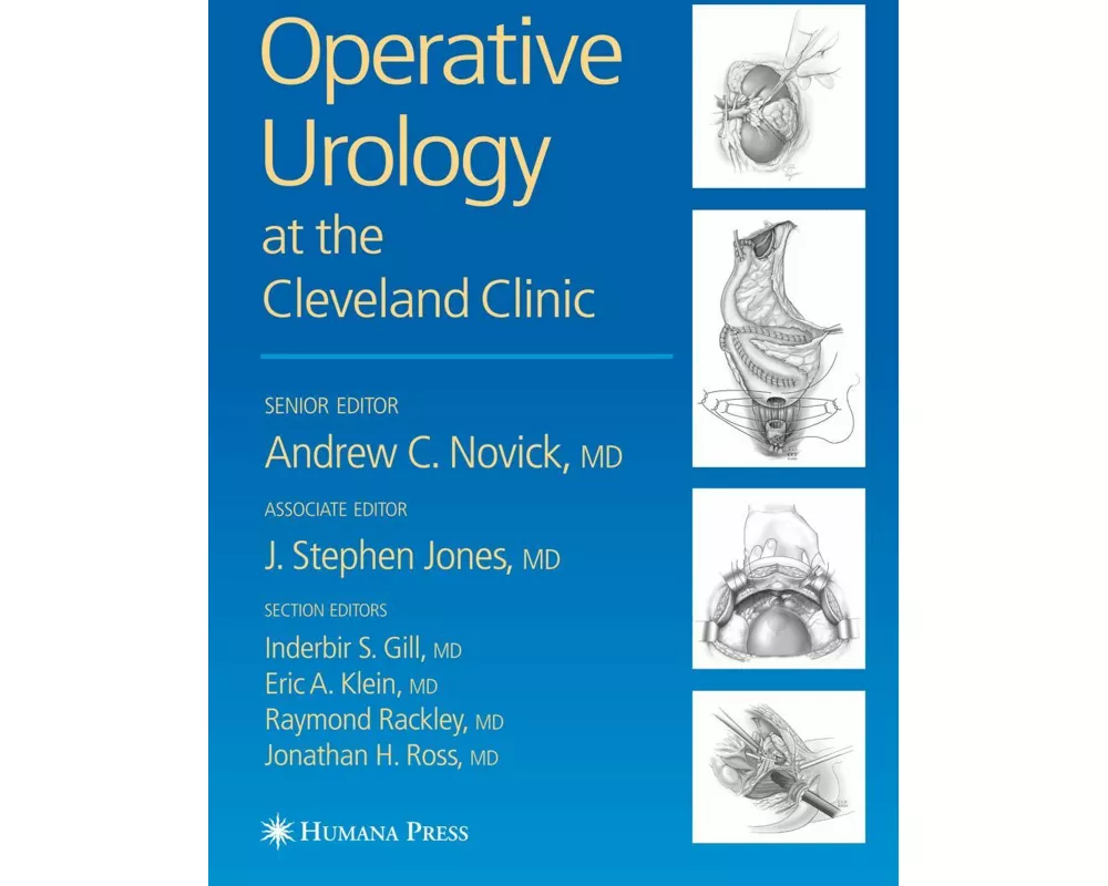 Operative Urology