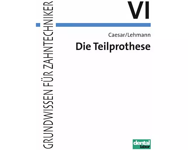 Die Teilprothese