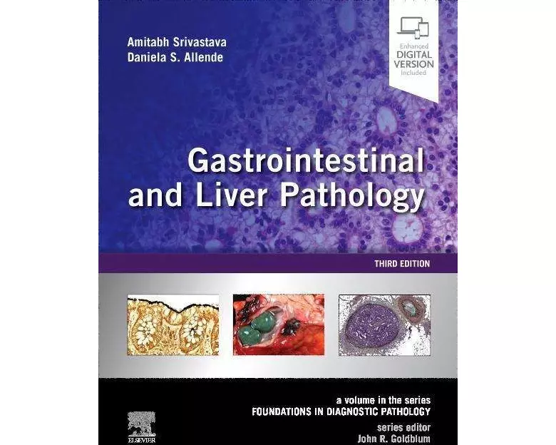 Gastrointestinal and Liver Pathology