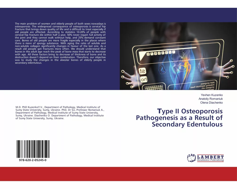 ¿ype II Osteoporosis Pathogenesis as a Result of Secondary Edentulous