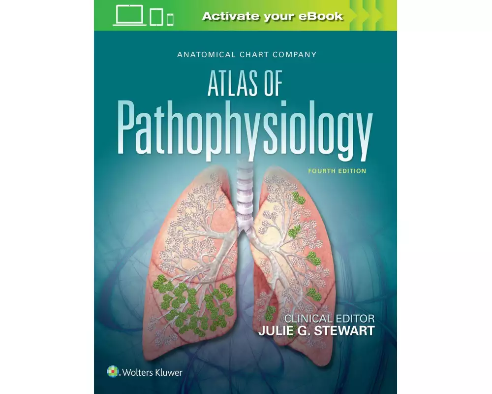 Anatomical Chart Company Atlas of Pathophysiology