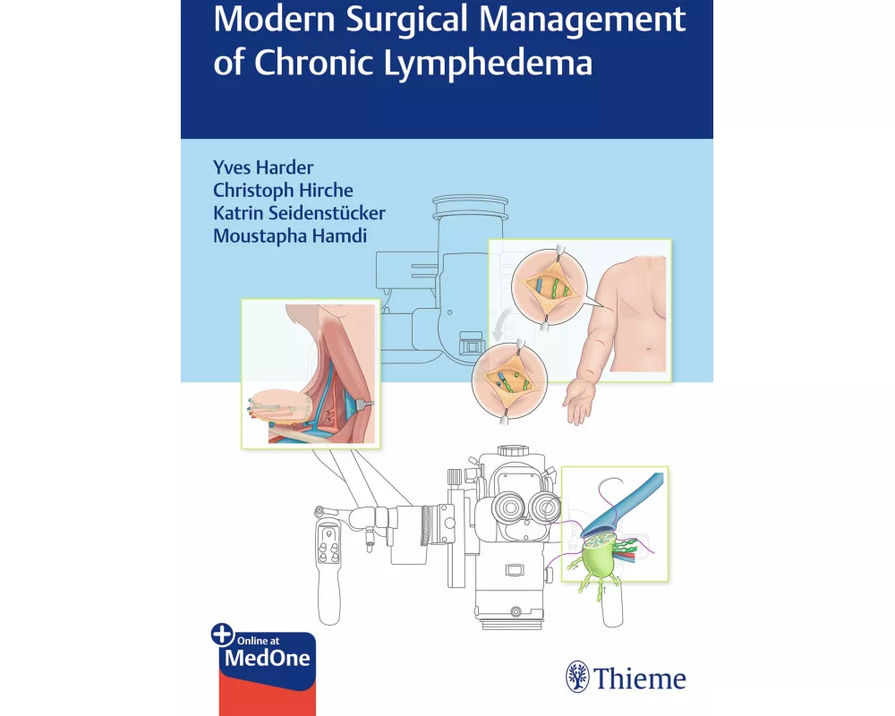 Modern Surgical Management of Chronic Lymphedema