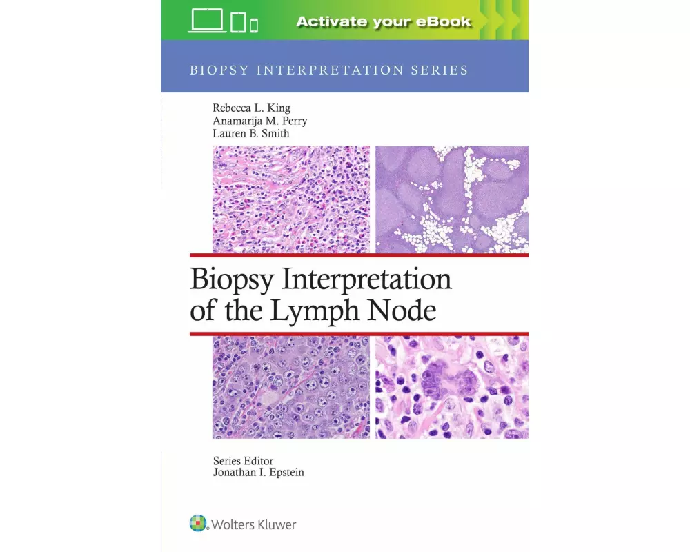 Biopsy Interpretation of the Lymph Node: Print + eBook with Multimedia