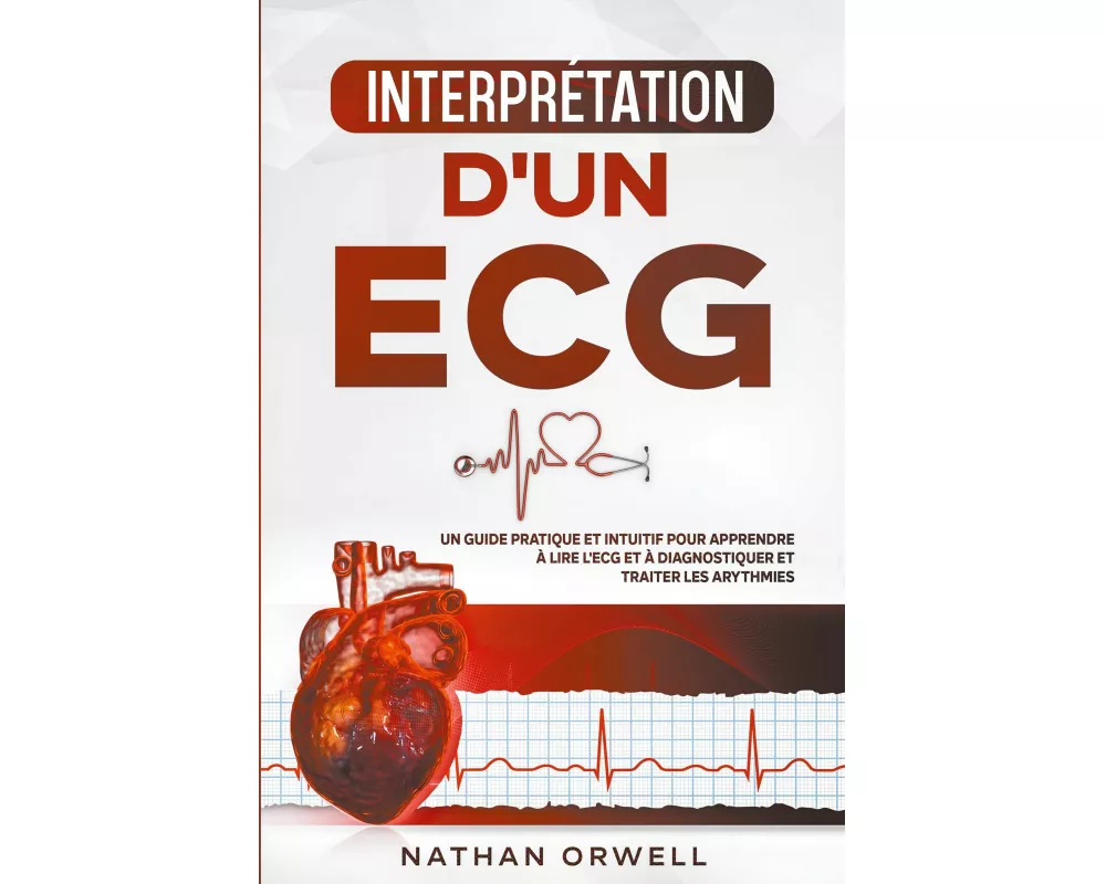 Interprétation d'un ECG