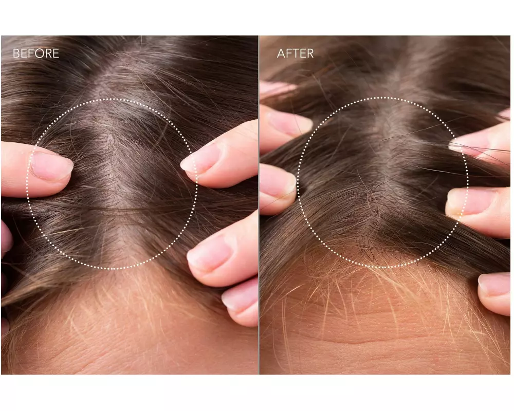 Foreo Scalp Recovery & Thick Hair Probiotic Serum 60 ml