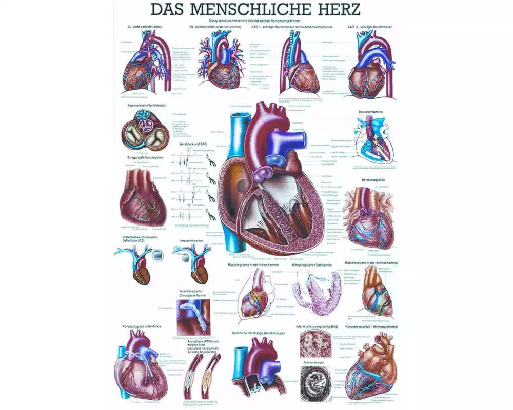 Rüdiger Anatomische Lehrtafel Das menschliche Herz 70 x 100 cm