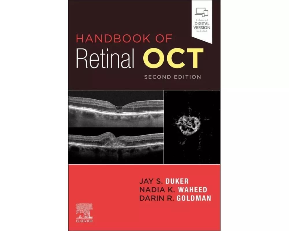 Handbook of Retinal OCT: Optical Coherence Tomography