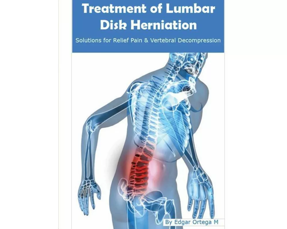 Treatment of Lumbar Disk Herniation: Back Pain Relief and Herniated Discs Solutions