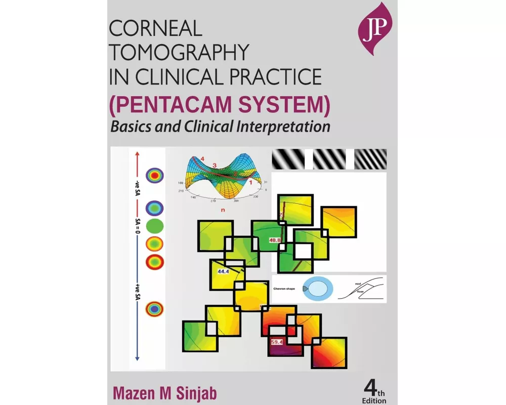 Corneal Tomography in Clinical Practice (Pentacam System)
