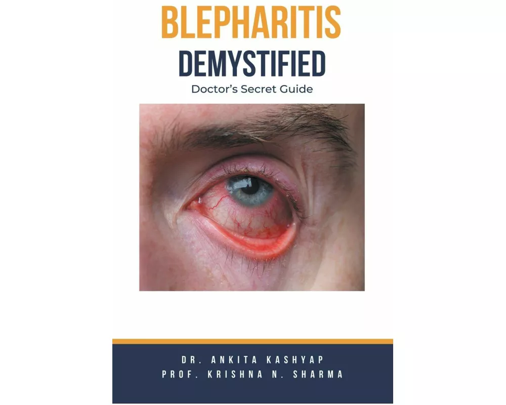 Blepharitis Demystified