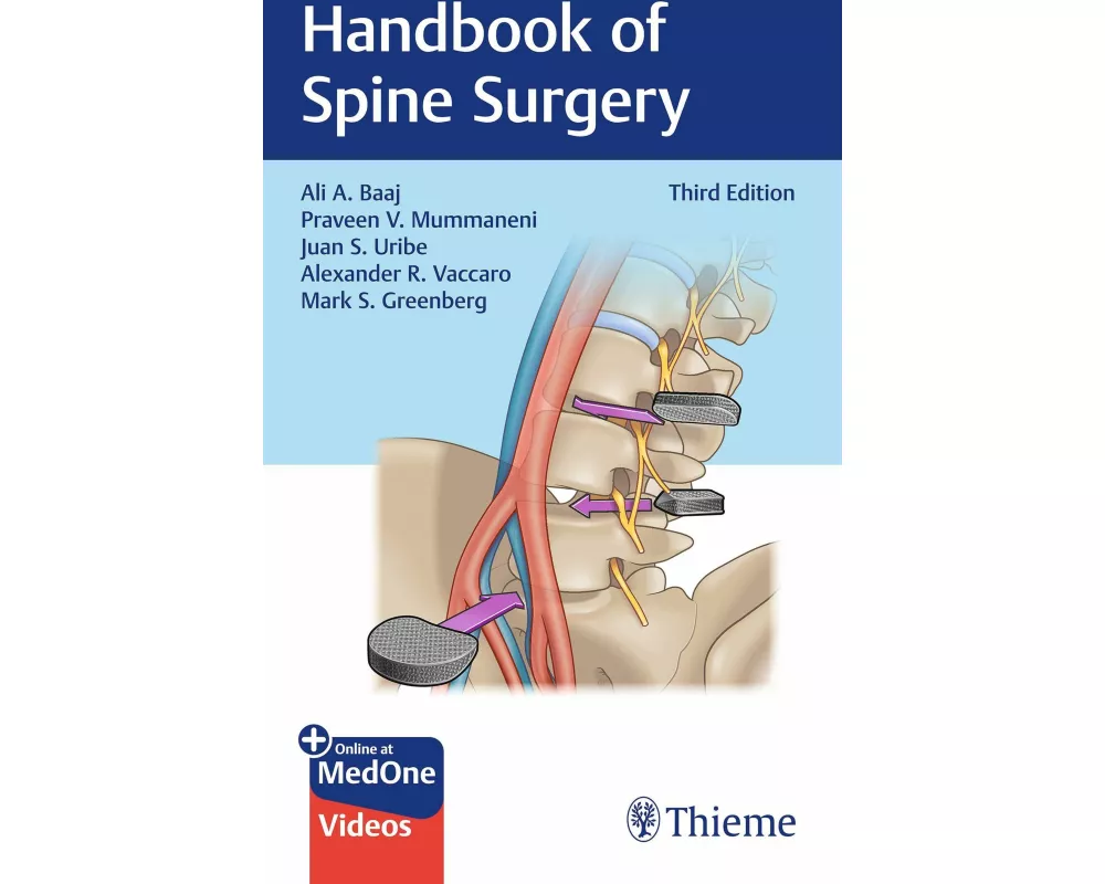 Handbook of Spine Surgery
