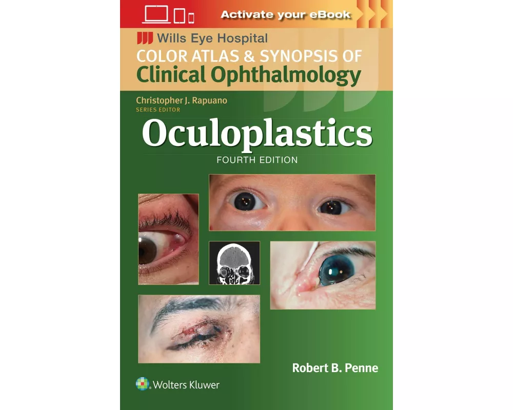 Oculoplastics