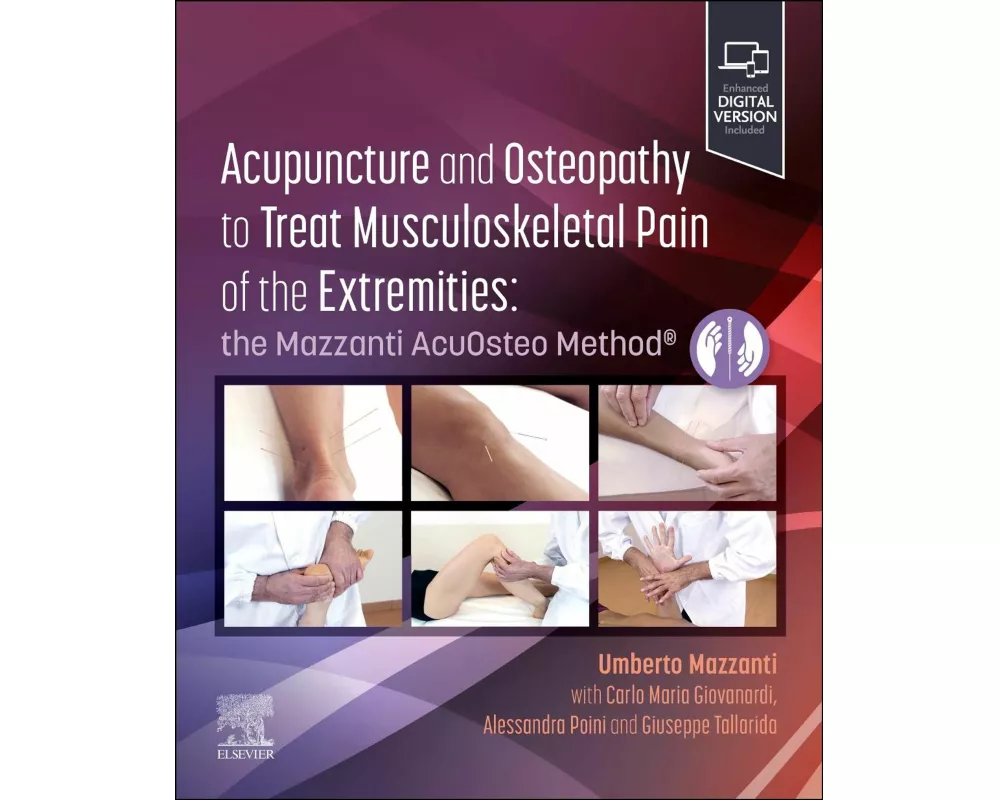 Acupuncture and Osteopathy to Treat Musculoskeletal Pain of the Extremities